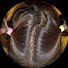 qiFNnHPlHJM-channel-avatar-Lice catching ASMR 