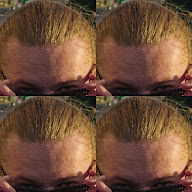 thumbnail img1x1