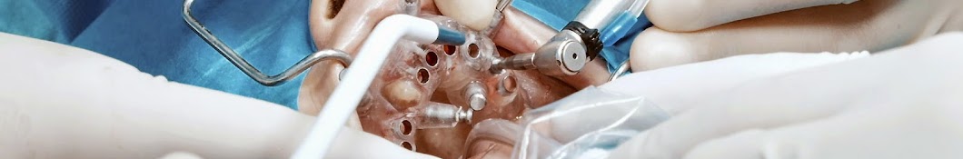 Digital Implantology Channel Giampiero Ciabattoni Avatar del canal de YouTube
