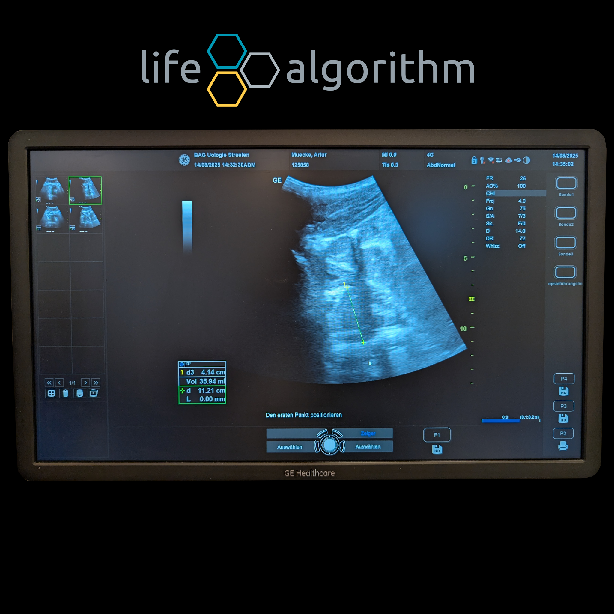 Post from life algorithm DE - Artur Mücke