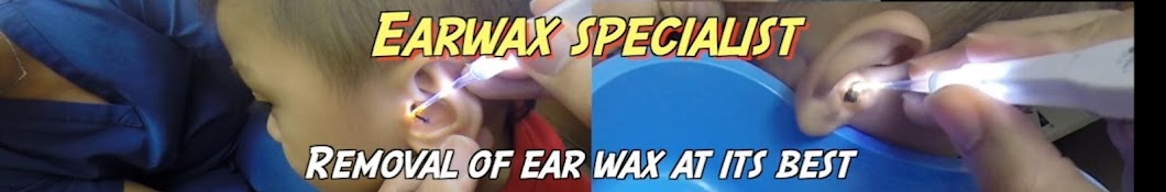 Earwax Specialist Avatar canale YouTube 