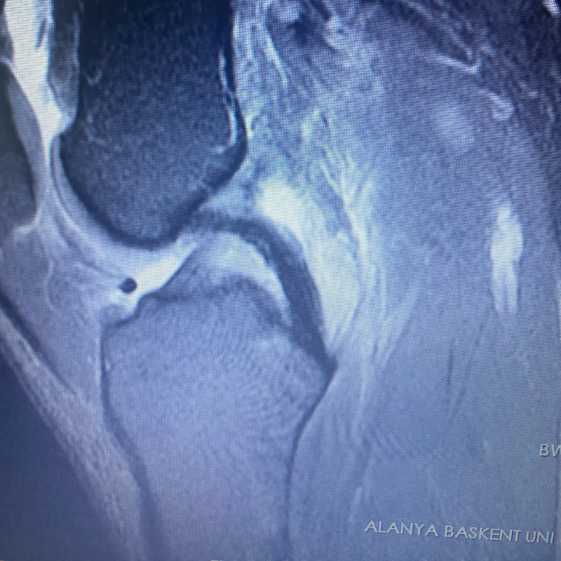 Orthopaedics & Trauma in Youtube