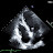 sonography in korea sky.