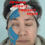 Лечение неврита лицевого нерва  logo