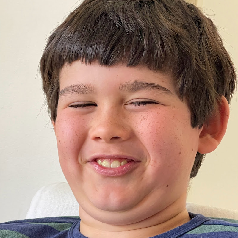 Big cheeks