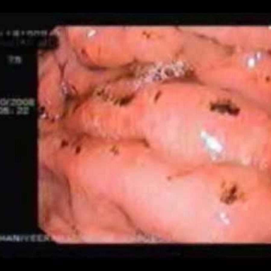 endoscopycentre Awatar kanału YouTube