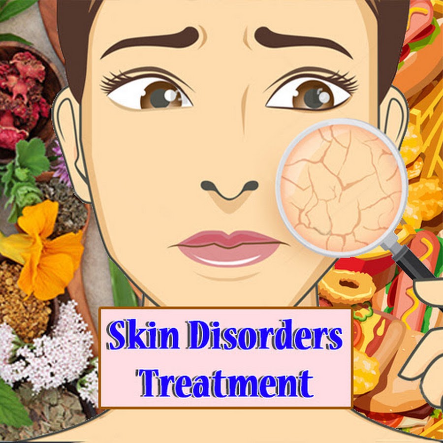 Ayurvedic Medicines For Skin Disorders