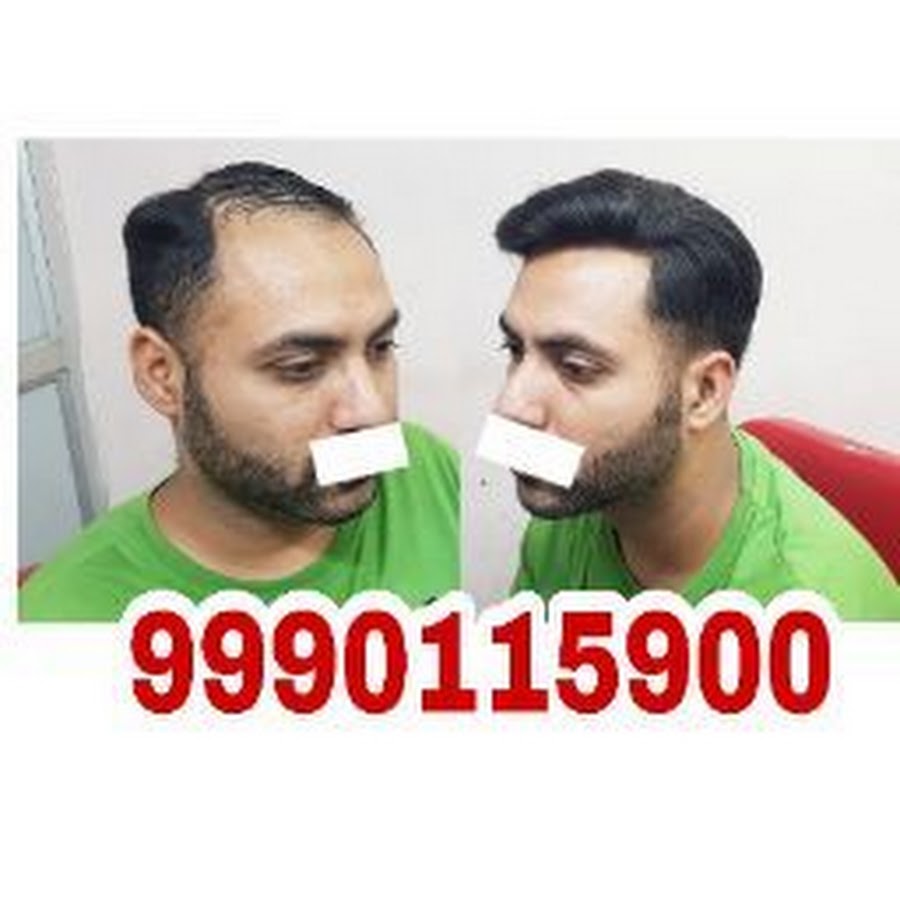 Hair wigs in delhi YouTube-Kanal-Avatar