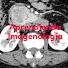 3LvcPXp-tXI-channel-avatar-Aprendiendo Imagenologia