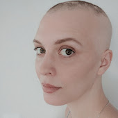 Alopecian Chic