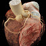 jdLoPCaRFBQ-channel-avatar-Stanford Healthcare Computed Tomography