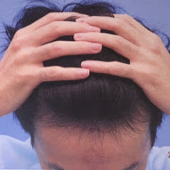 マグネシウム秀 AGA改善チャンネルアイコン画像