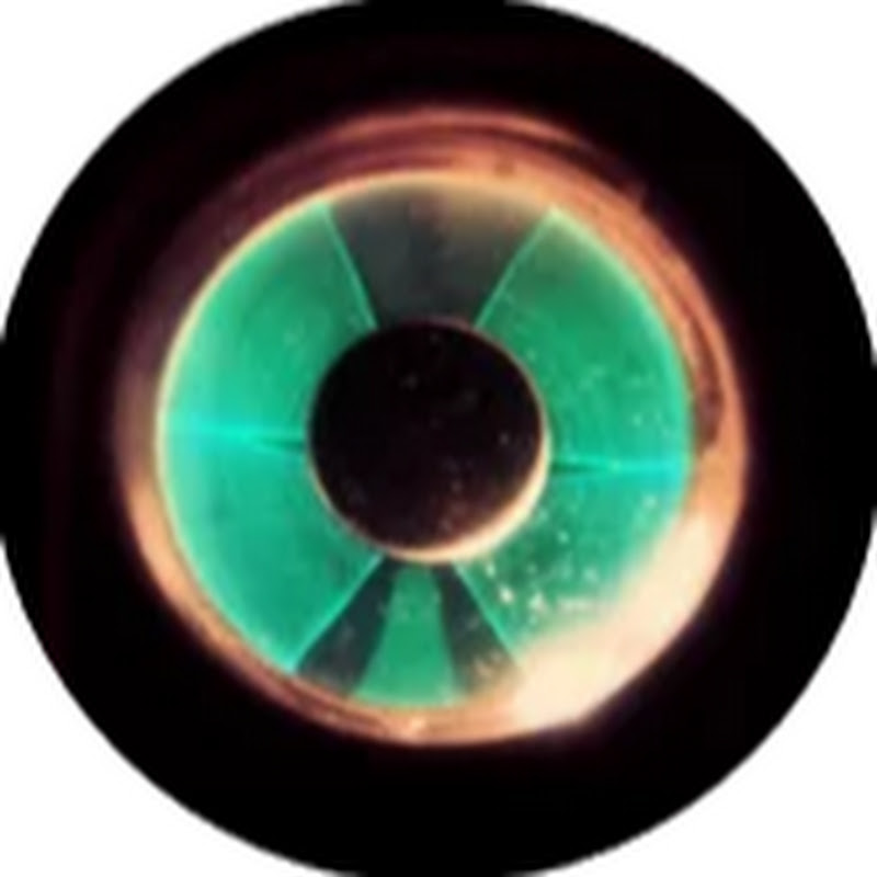 retrotor