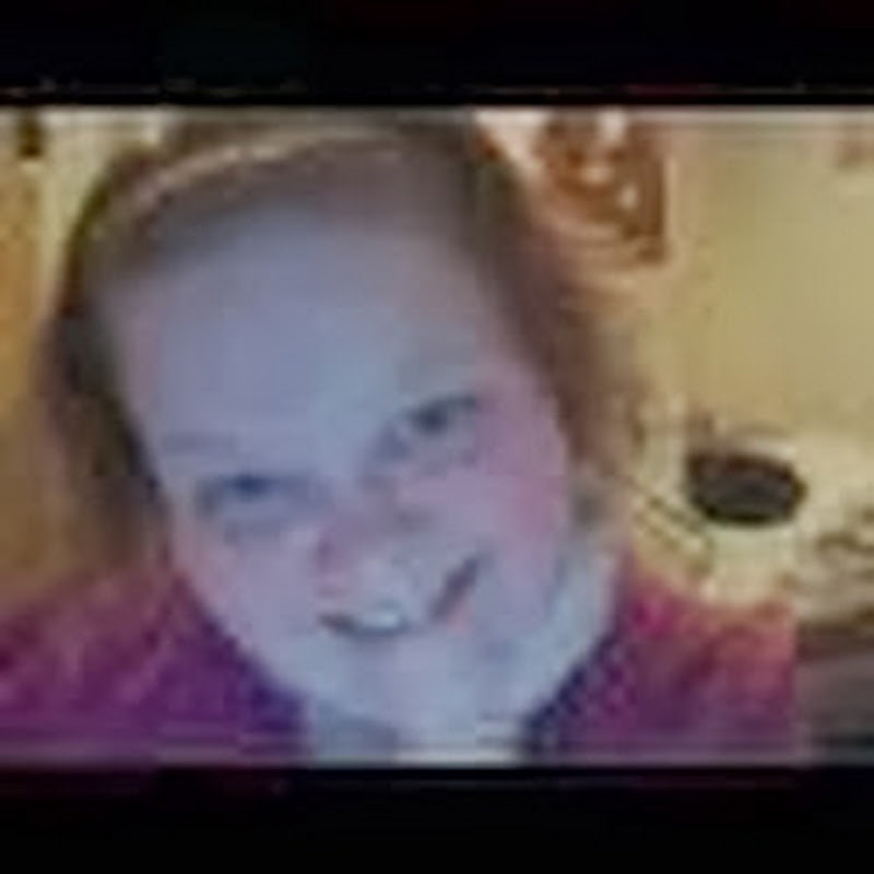 beautyisntskindeep