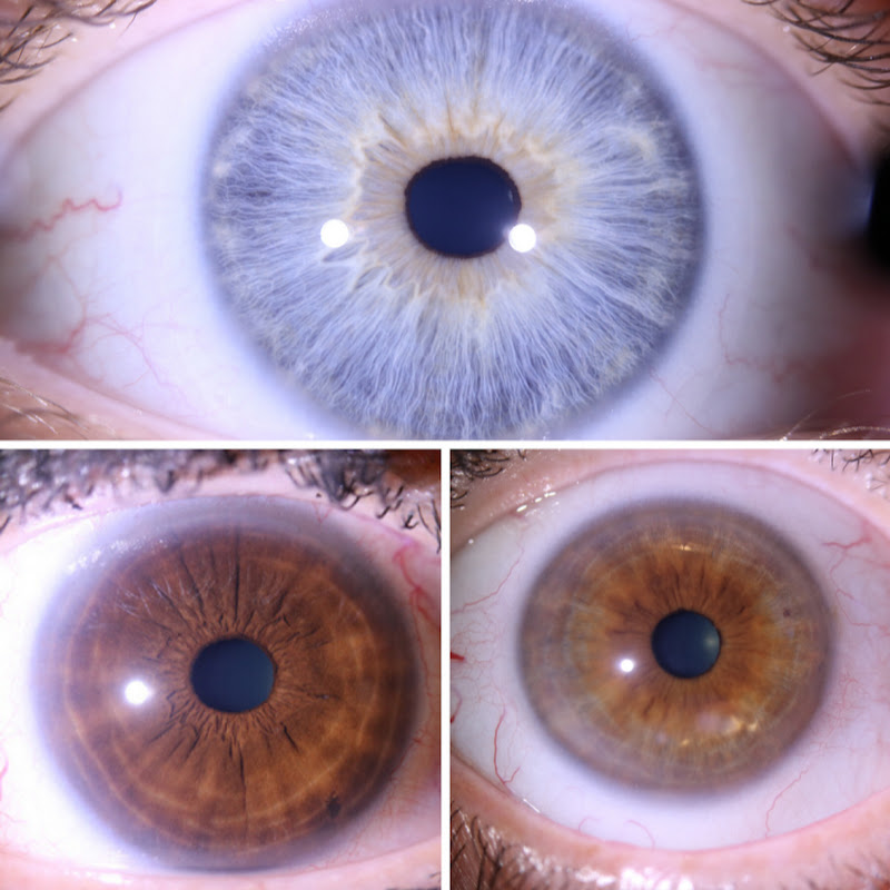 Judith Cobb - Iridology Education