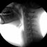 grIPYEwbCy4-channel-avatar-TCD Dysphagia