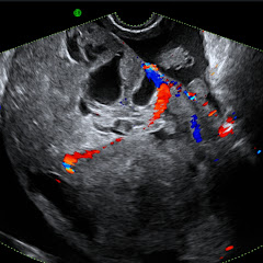Gynaecology Ultrasound