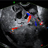 pUDjkNvsfEc-channel-avatar-Gynaecology Ultrasound