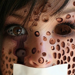 閲覧注意！ニキビ・膿・うじ虫のグロい映像チャンネルアイコン画像