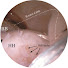 b3PPULeld3o-channel-avatar-Arthroscopy Techniques