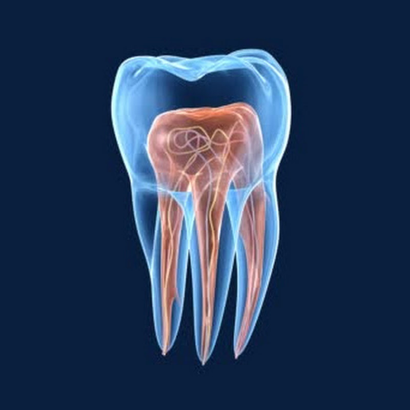 Root Canal Pro