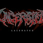 Lacerated logo