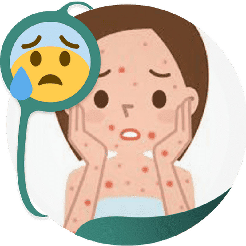 Blackheads icon