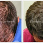 Evolution Hair Loss Institute and Advanced Trichology Products - William Gaunitz WTS logo