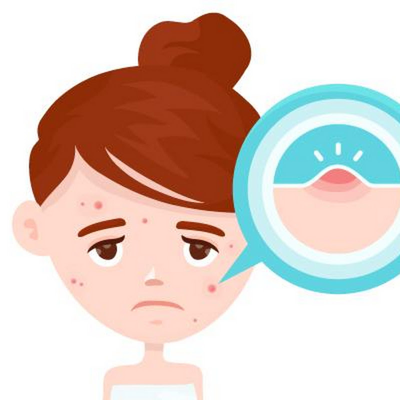 Acne Removal icon