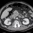 sxXHiKEXp18-channel-avatar-Abdominal Radiology Case Conference