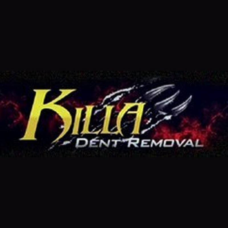 Killa Dent Removal