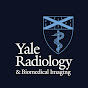 Yale Radiology and Biomedical Imaging logo