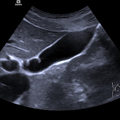 AG Sonographie Charité