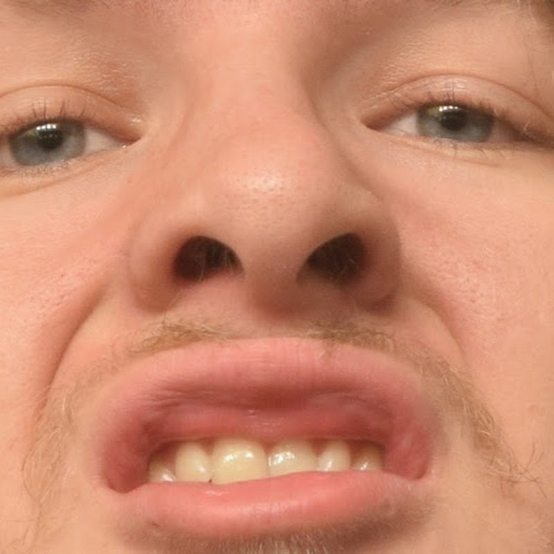 GNARHOFF