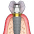 xtxcUDnm1cU-channel-avatar-Dr VK's Dental Skool