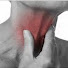 sOwqCH6PJDM-channel-avatar-Esophagectomy- My Journey