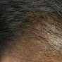 Dayton Trichology Hair loss Control Clinic logo