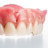 Interchrome Dental