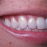fU3HwwdphoA-channel-avatar-PDA - Introduction to Dentistry and Lab