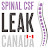 Spinal CSF Leak Canada