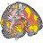 Principles of fMRI