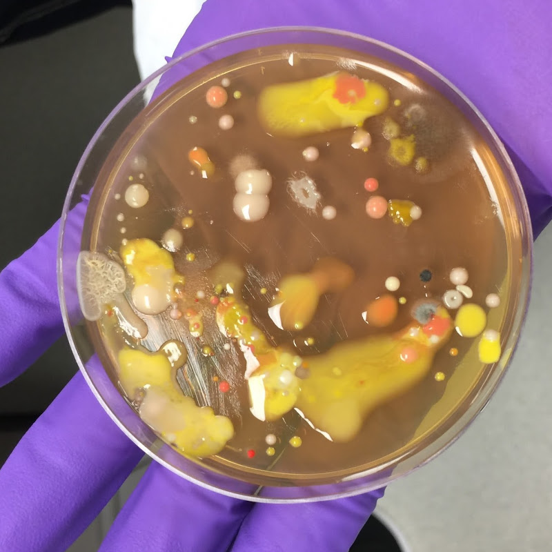 Microbes and Molecules