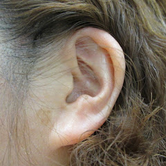 耳垢そうじ/earwaxアイコン画像