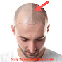 Scalp Micropigmentation World logo
