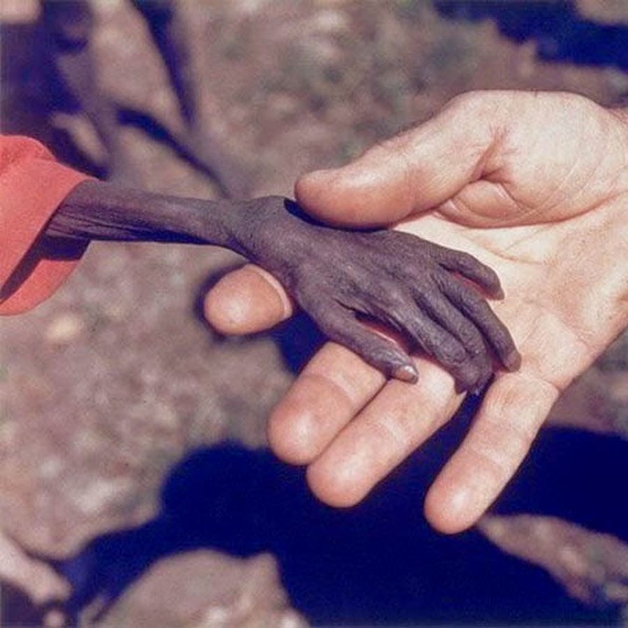 "Умирающий ребенок и Стервятник", Кевин Картер, 1993. Голодный мальчик Уганда 1980. Голодный мальчик и миссионер Уганда 1980 год фотограф Mike wells.. Тысячи рук и голодных