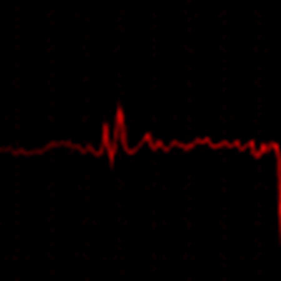 Сердцебиение остановилось. Кардиограмма гиф. Пульс. Кардиограмма остановки сердца. Пульс на черном фоне.
