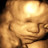 Nos Bebes En 3d A Entre 27 31sa Par Www Babycocoon3d Com Youtube