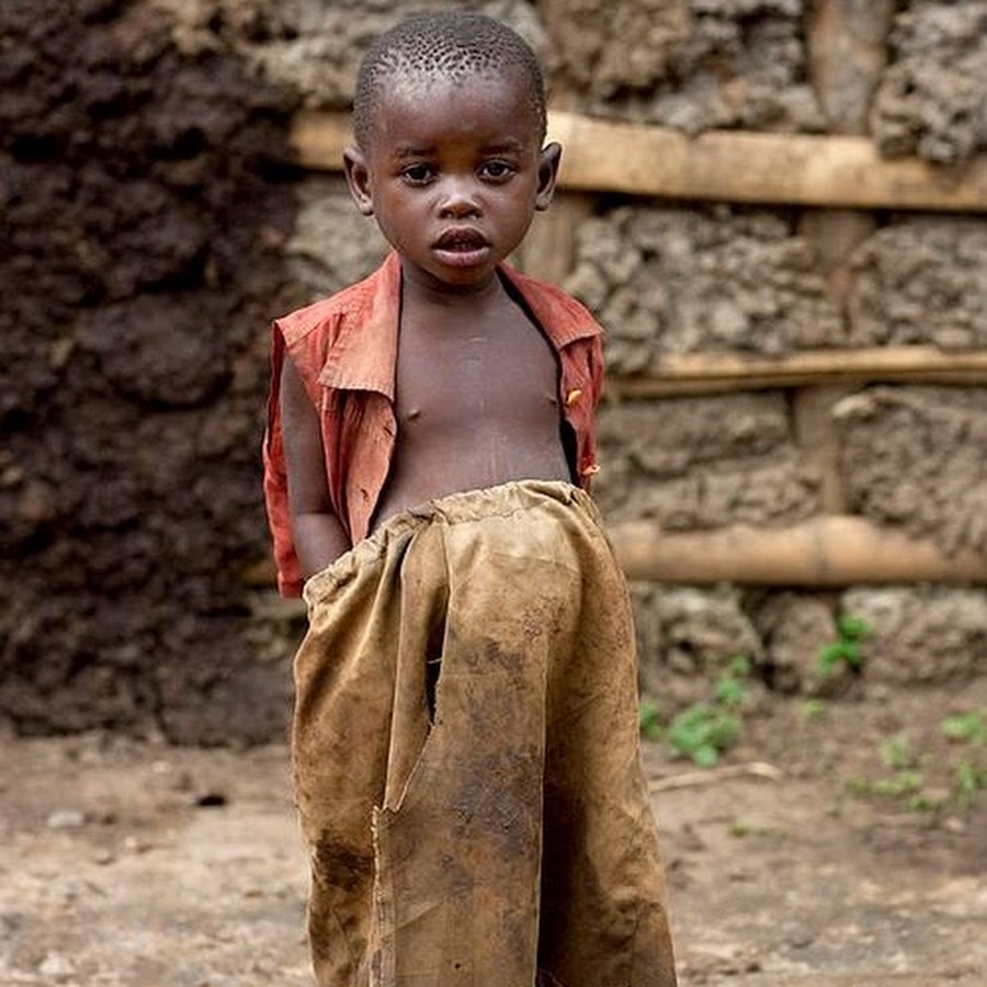 Голодные подростки. Бедные африканские дети.