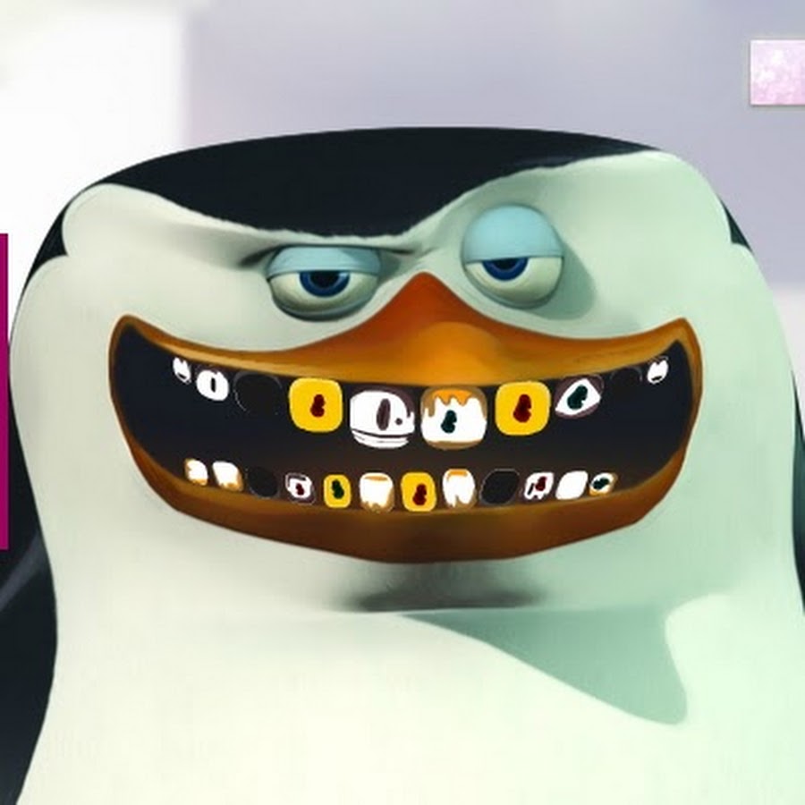 стоматолог консультирует. Rocket на зубах руда. Rocket x serebro - cладкий инкассатор. я имею валюту на зубах. гиперестезия твердых тканей зуба.