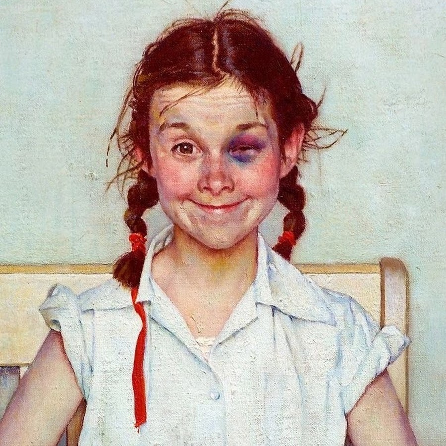 Девочка с синяком под глазом картина